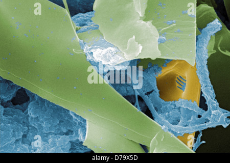 Scanning Electron Micrograph Untreated Water Sample Stock Photo