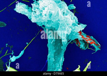 Scanning Electron Micrograph Untreated Water Sample Stock Photo