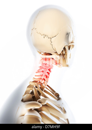 Neck pain, conceptual artwork Stock Photo