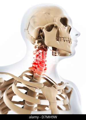 Neck pain, conceptual artwork Stock Photo