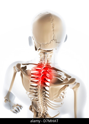 Neck pain, conceptual artwork Stock Photo