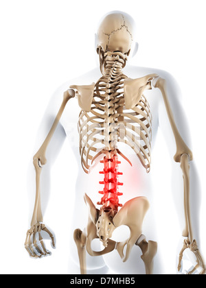 Lower back pain, conceptual artwork Stock Photo