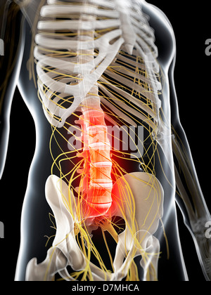 Lower back pain, conceptual artwork Stock Photo