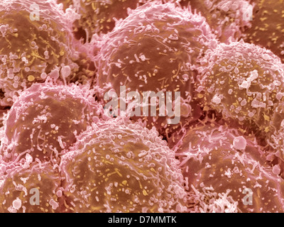 Lung cancer cells, SEM Stock Photo
