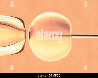 In vitro fertilisation, artwork Stock Photo