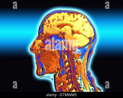 Coloured MRI scan of the human head Stock Photo