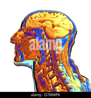 Coloured MRI scan of the human head Stock Photo