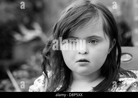 Young Girl with Downs Syndrome. Stock Photo