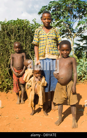 A family beside the road living in poverty child with obvious worms African Burundian Children Eastern Africa Female Women Girl Stock Photo