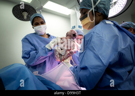 A newborn bady takes his first breath at Stepping Hill Hospital Stockport UK, the baby boy was born by a C section operation Stock Photo