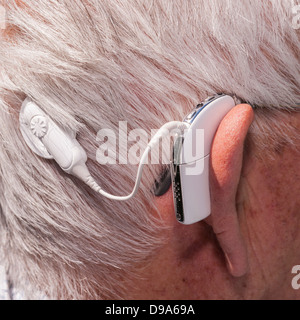 A close up picture of an elderly man with his cochlear implant hearing aid in England, Great Britain, Uk Stock Photo