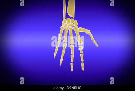 Conceptual image of bones in human hand. Stock Photo