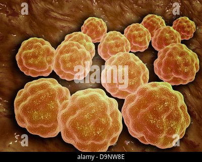 Microscopic view of Rubella virus Stock Photo
