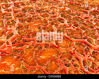 Close-up view of athlete's foot fungus. Stock Photo