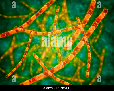 Microscopic view of Anthrax.