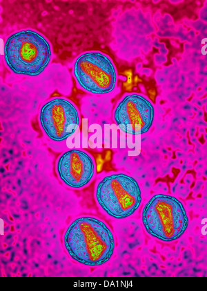 RETROVIRUS, TEM Stock Photo - Alamy