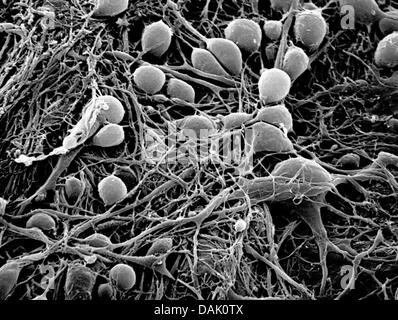 HANDOUT - An undated scanning electron microscope handout picture from the Max Planck Institute for Molecular Biomedicine shows human neurons grown from induced pluripotent stem cells in Muenster, Germany. Numerous scientists at the institute of the University of Muenster are involved in stem cell research. Photo: Mpi Muenster Stock Photo
