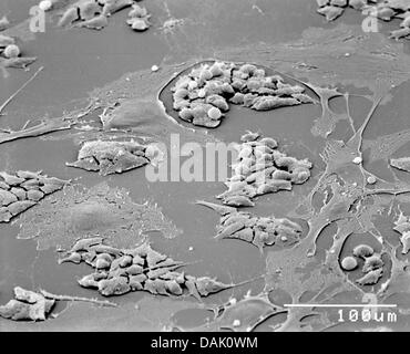 HANDOUT - An undated scanning electron microscope handout picture from the Max Planck Institute for Molecular Biomedicine shows embryonic stem cells of mice in Muenster, Germany. Numerous scientists at the institute of the University of Muenster are involved in stem cell research. Photo: Mpi Muenster Stock Photo