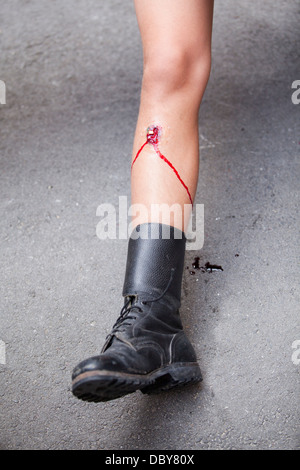 gunshot wound on soldier's leg Stock Photo - Alamy