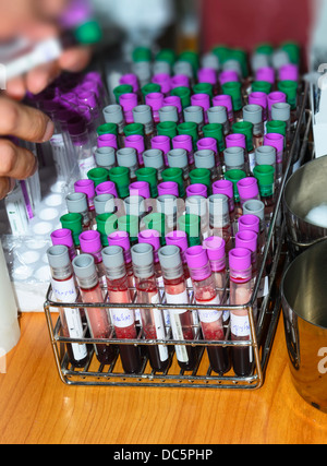 Many Blood Samples blood sampling in the laboratory, donation, dressing,. High quality ...