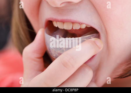correction of child malocclusion by pre-orthodontic trainer Stock Photo