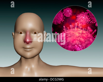 Common cold influenza virus with microscopic close-up. Stock Photo