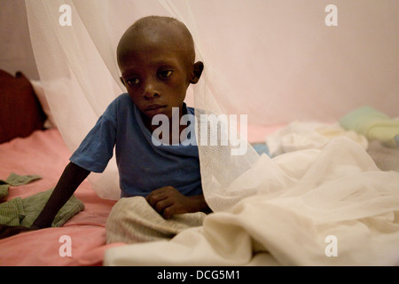 HIV positive child is treated at an orphanage in Moshi, Tanzania. Stock Photo