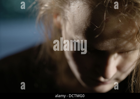 Bruises on forehead. Domestic violence Stock Photo