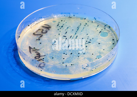 Petri dish with colonies of microorganisms Stock Photo