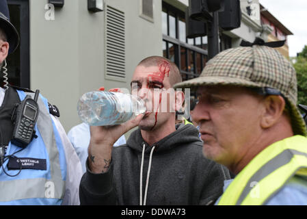London, UK. 07th Sep, 2013. Bleeding EDL protester at Queen Elizabeth street, as an EDL protest forms up. Several hundred EDL protesters marched across Tower Bridge to Aldgate Station. Credit:  tinite photography/Alamy Live News Stock Photo