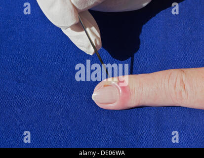 Bacterial infection, inflammation, index finger, pus, abscess, disinfected needle, lancing Stock Photo