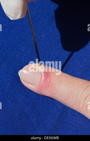 Bacterial infection, inflammation, index finger, pus, abscess, disinfected needle, lancing Stock Photo