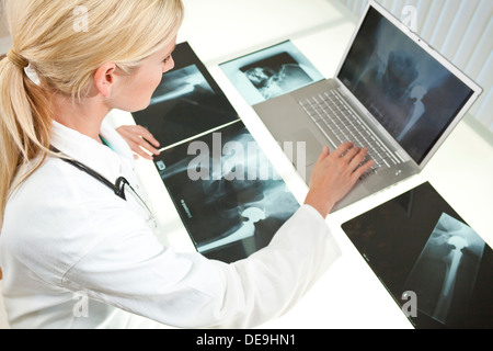 A blond female medical doctor looking at x-rays of hip replacement and using laptop in a hospital Stock Photo