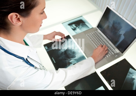 A blond female medical doctor looking at x-rays of hip replacement and using laptop in a hospital Stock Photo