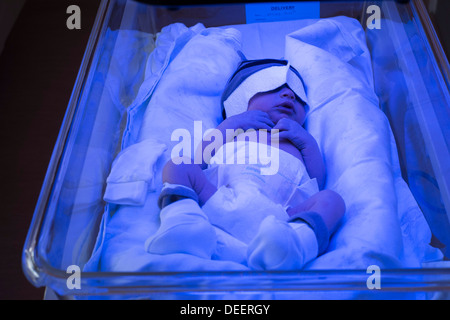 A newborn baby boy getting treated for jaundice under a phototherapy lamp. Stock Photo