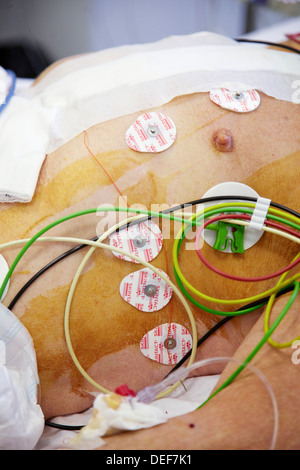 Vital signs monitoring in ICU unit Stock Photo - Alamy