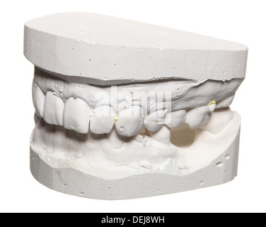 Dental casting gypsum model plaster cast stomatologic human jaws prothetic laboratory, technical shots Stock Photo