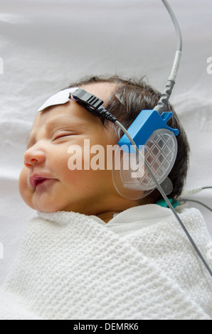 Newborn baby hearing screening test Auditory Brainstem Response Stock Photo