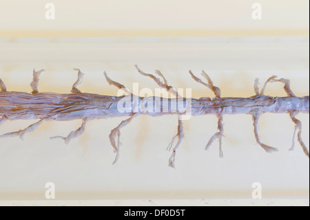 Plastination specimen of spinal cord Stock Photo