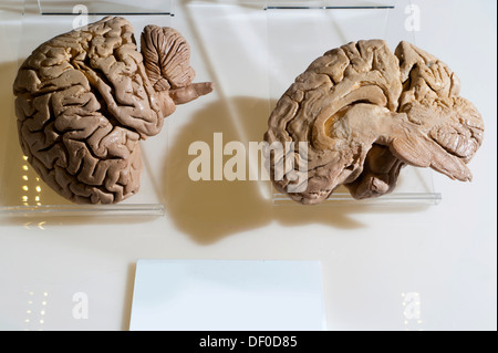 Plastination specimen of midsagittal cut of human brain Stock Photo