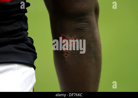Houston, Texas, USA. 29th Sep, 2013. SEP 29 2013: A detailed shot of a gash suffered by Houston Texans free safety Ed Reed #20 during the NFL regular season game between the Houston Texans and the Seattle Seahawks from Reliant Stadium in Houston, TX. Seattle won, 23-20 in overtime © csm/Alamy Live News Stock Photo