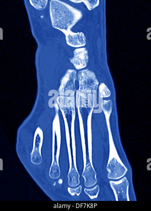 FOOT, SCAN Stock Photo