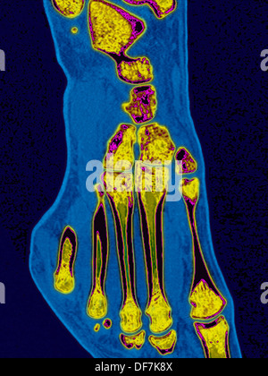 FOOT, SCAN Stock Photo