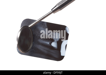 x-ray of tooth film detail and dental instrument isolated on white Stock Photo