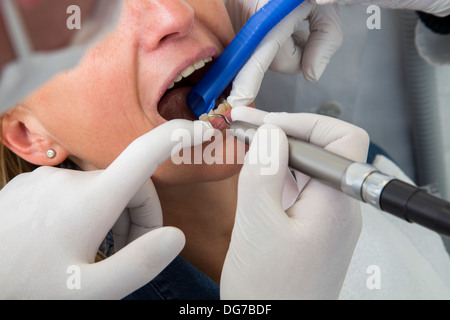 Dental practice, dentistry. Woman at a dentist treatment. Stock Photo