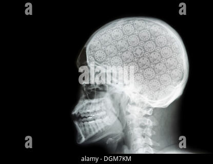 X-ray of a skull with cogs Stock Photo