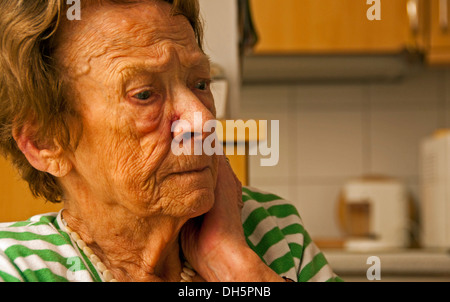 Elderly woman, 86, marked by age and extended periods of illness, in an assisted living facility Stock Photo