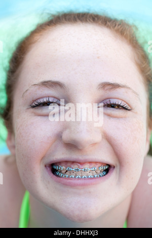 Girl with dental braces Stock Photo