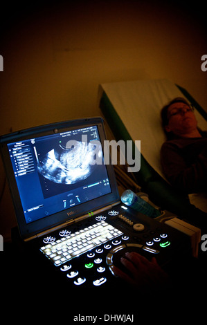 TRANSVAGINAL ULTRASOUND Stock Photo