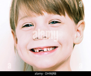 LOSING MILK TEETH Stock Photo